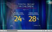 Children Cavities Increasing
