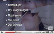 Dry Mouth Symptoms Cure